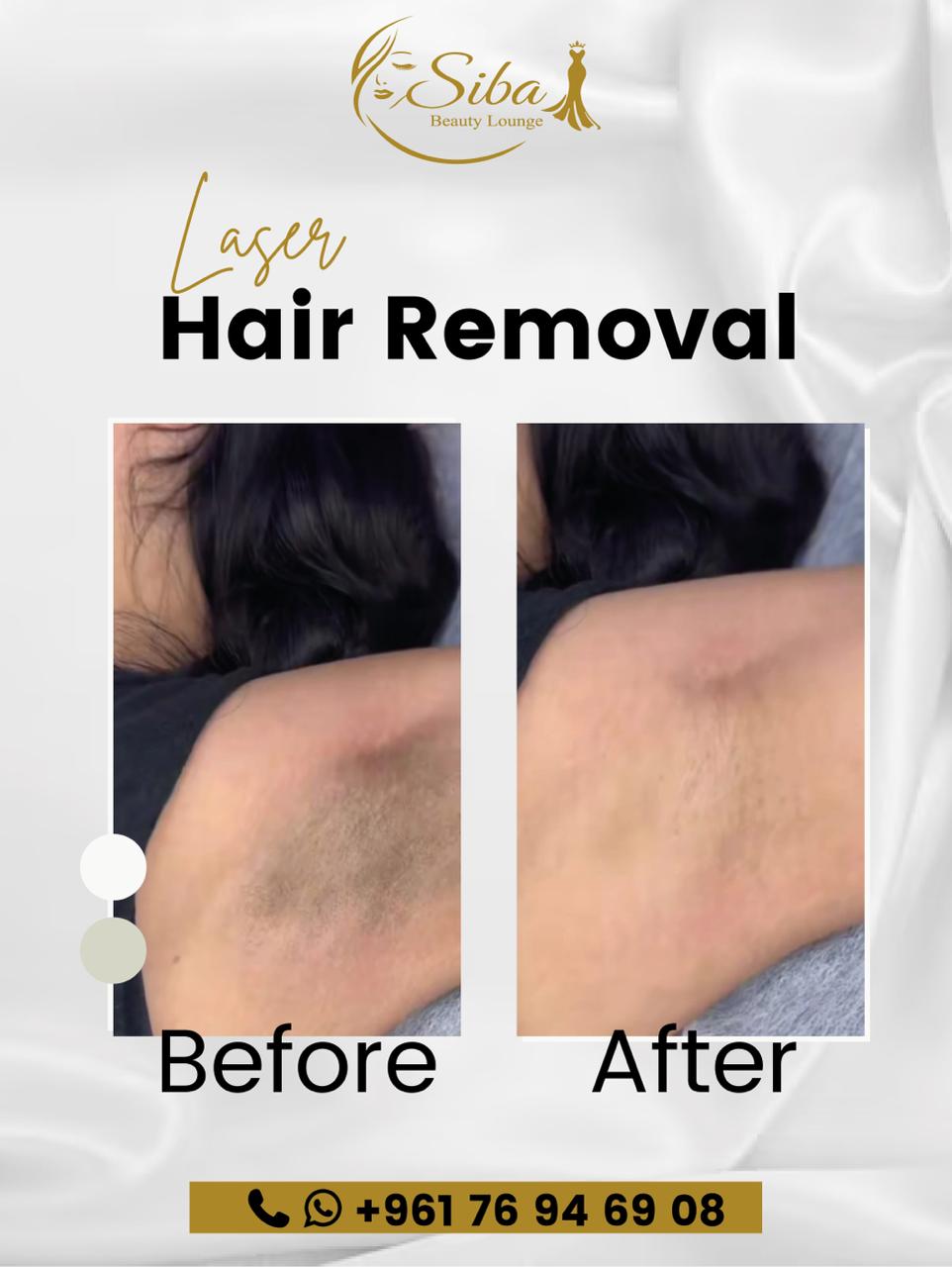 Madero Therapy - جلسة تدليك 1